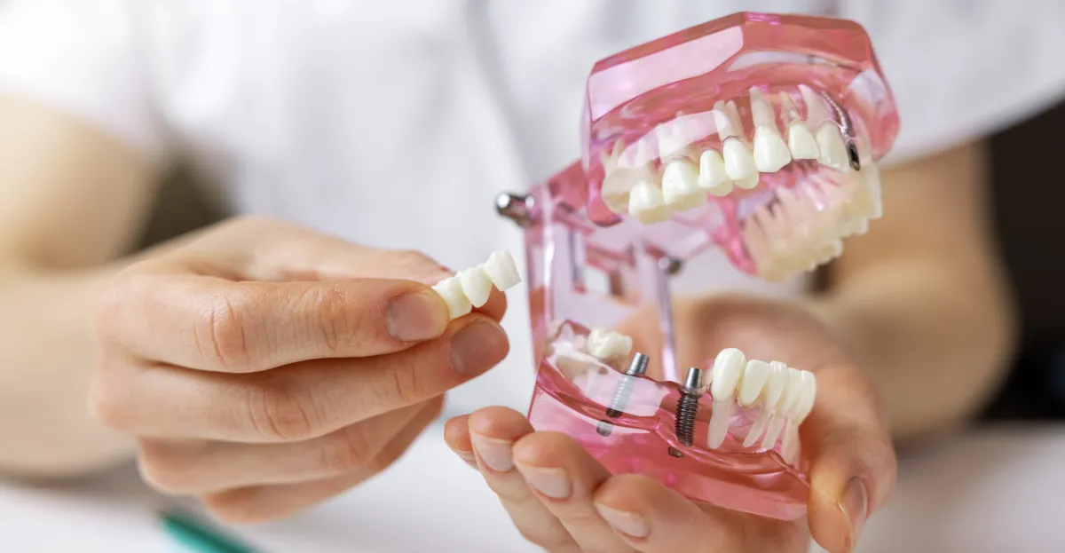 Dental Implants in Sandy Springs: What Patients Should Expect