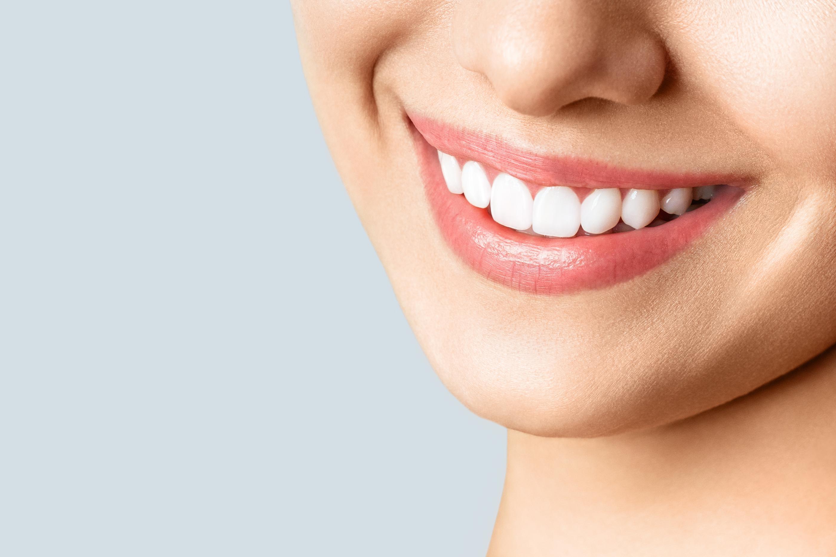 Teeth Whitening Sandy Springs, GA